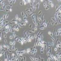 HFL1 人胚肺成纤维细胞(有限细胞系)