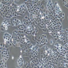 NCI-H23 人非小细胞肺癌细胞