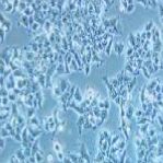 DMS 53 人肺癌细胞