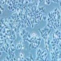 DMS 53 人肺癌细胞