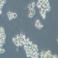 NCI-H82 人小细胞肺癌细胞