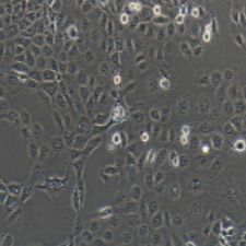 NCI-H1650 人肺支气管癌细胞