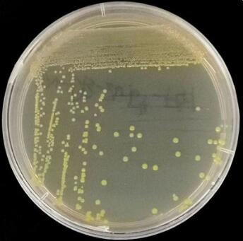 培养基灭菌方法全方面解读