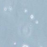 NCI-H524 人非小细胞肺癌细胞