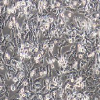 NCI-H1703 人肺鳞癌细胞