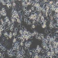 NOZ 人胆囊癌细胞