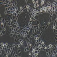 HCT-15 人结肠癌细胞