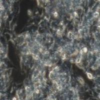 Hep G2 人肝癌细胞