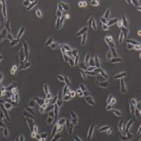 Bel-7405 人肝癌细胞