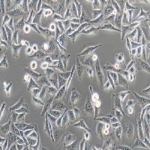 MGC-803 人胃癌细胞