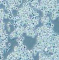 MKN-45 人胃癌细胞