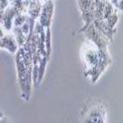 LS1034 人结肠腺癌细胞