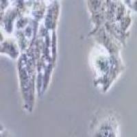 LS1034 人结肠腺癌细胞