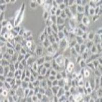 SMMC-7721 人肝癌细胞