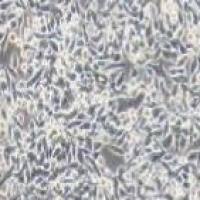 SW620 人结直肠腺癌细胞