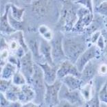 NCI-H522 人非小细胞肺癌腺癌细胞