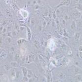 PLC-PRF-5 人肝癌亚力山大细胞