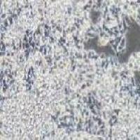 CW2 人结肠癌细胞