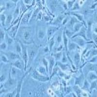 KYSE410 人食道鳞状癌细胞