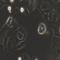 Caco-2 人结肠癌细胞