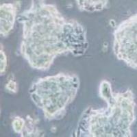 NCI-H1688 人经典小细胞肺癌细胞