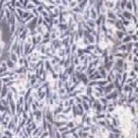 P53R 人结直肠癌细胞