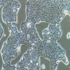 NCI-N87 人胃癌细胞