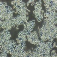 COLO320 人结直肠腺癌细胞