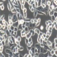 HCT-8 人回盲肠癌细胞