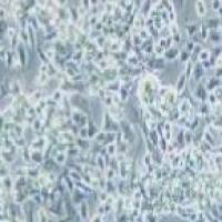 SNU-398 人肝癌细胞