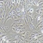 786-O 人肾透明细胞癌细胞
