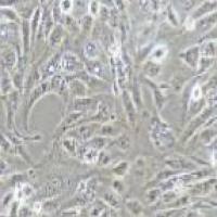 786-O 人肾透明细胞癌细胞