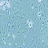 HuCCT1 人胆管癌细胞