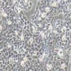 CX-1 人大肠癌细胞