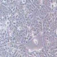 TE-12 人食管癌细胞