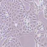 MKN-74 人胃癌细胞