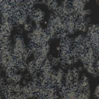 LS174T 人结直肠腺癌细胞