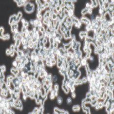 COLO320 DM人结直肠腺癌细胞