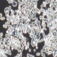 COLO320 DM人结直肠腺癌细胞