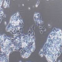 GS-HEPG2 人肝癌细胞亚型