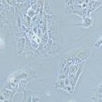 NCI-H2228 人肺癌细胞