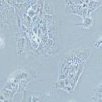 NCI-H2228 人肺癌细胞