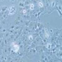 KYSE150 人食管癌细胞