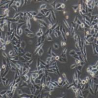 Hep3B2.1-7 人肝癌细胞