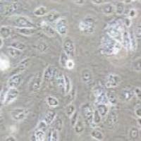 SNU-182 人肝癌细胞