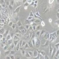 TU138 人喉癌细胞