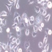 ECV-304 人膀胱癌细胞