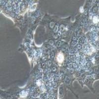 Capan-1 人胰腺癌细胞