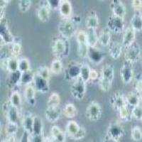 IHH4 人甲状腺乳头状癌细胞