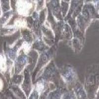 BT-B 人宫颈癌细胞